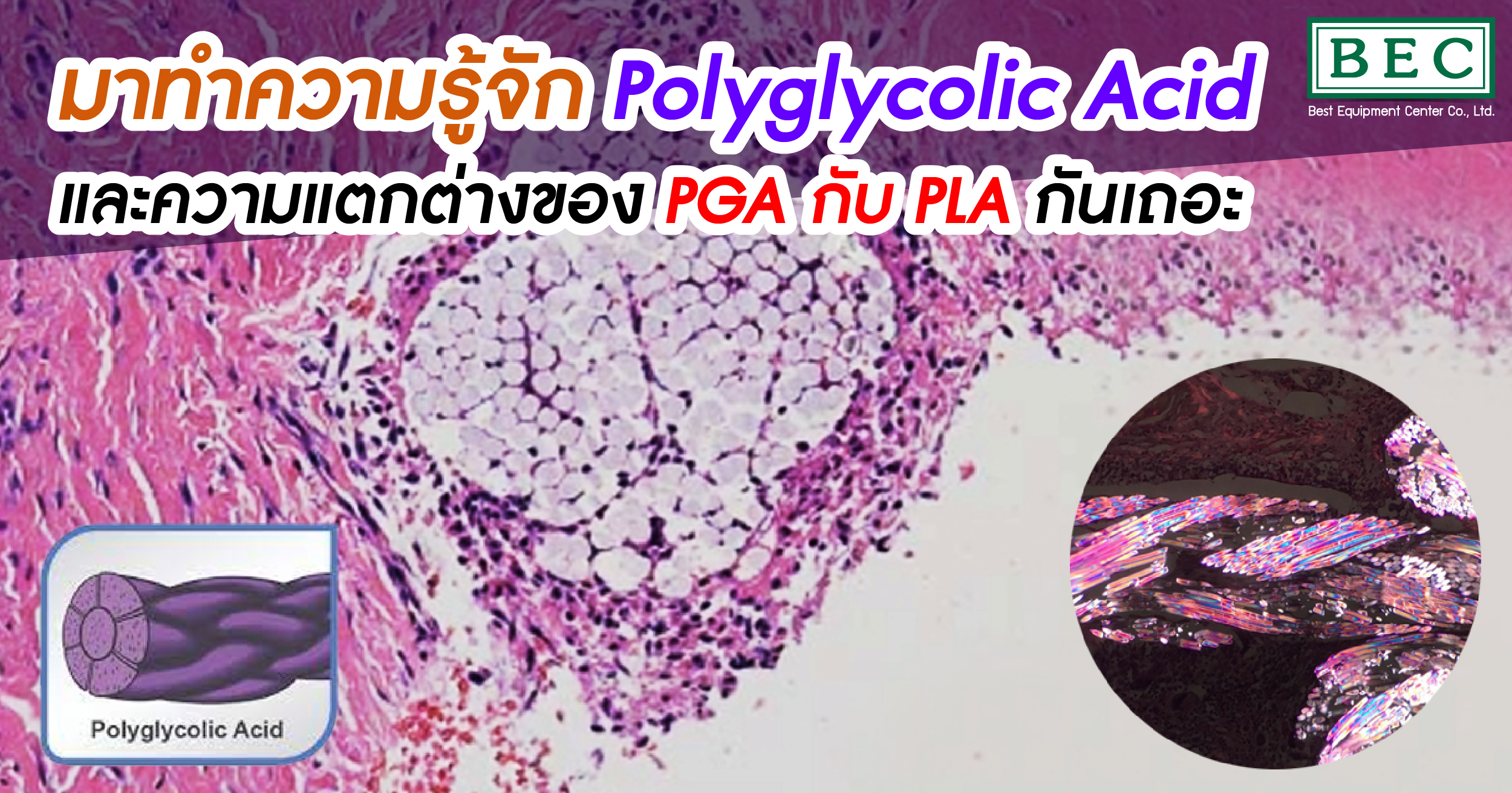 มาทำความรู้จัก Polyglycolic acid และความแตกต่างของ PGA กับ P | Best ...